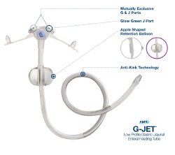 G-J Feeding Tube Low Profile G-JET 14 Fr 45 cm