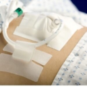 Cath-Secure Tube Holder Single Hook and Loop