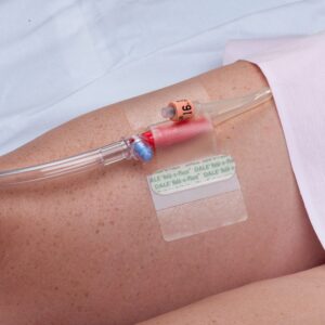 Hold-n-Place Catheter Holder One Size